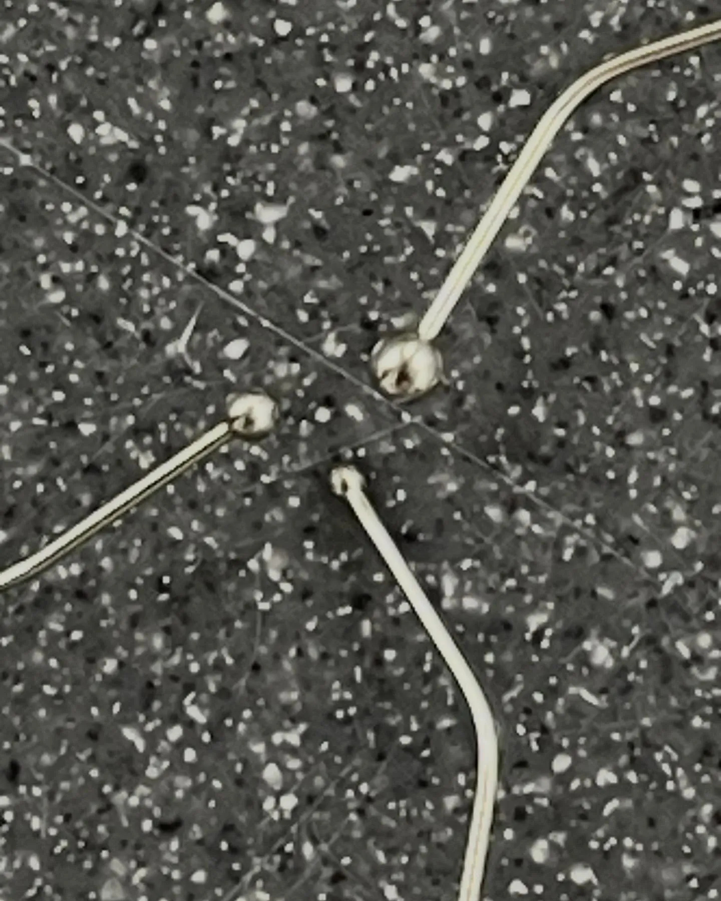 歯科医院でのクラウン治療において、しっかりとしたクリアランス...