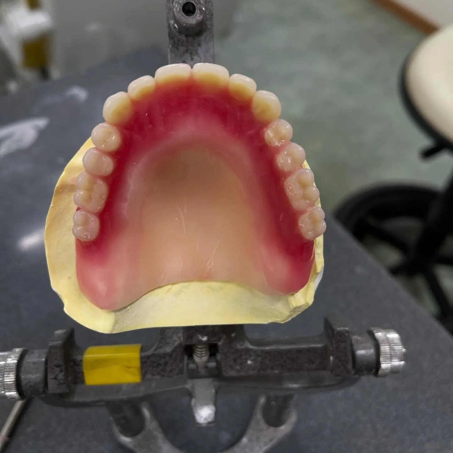 上あごの総入れ歯(総義歯)は、多くの方にとって飲食時に違和感...