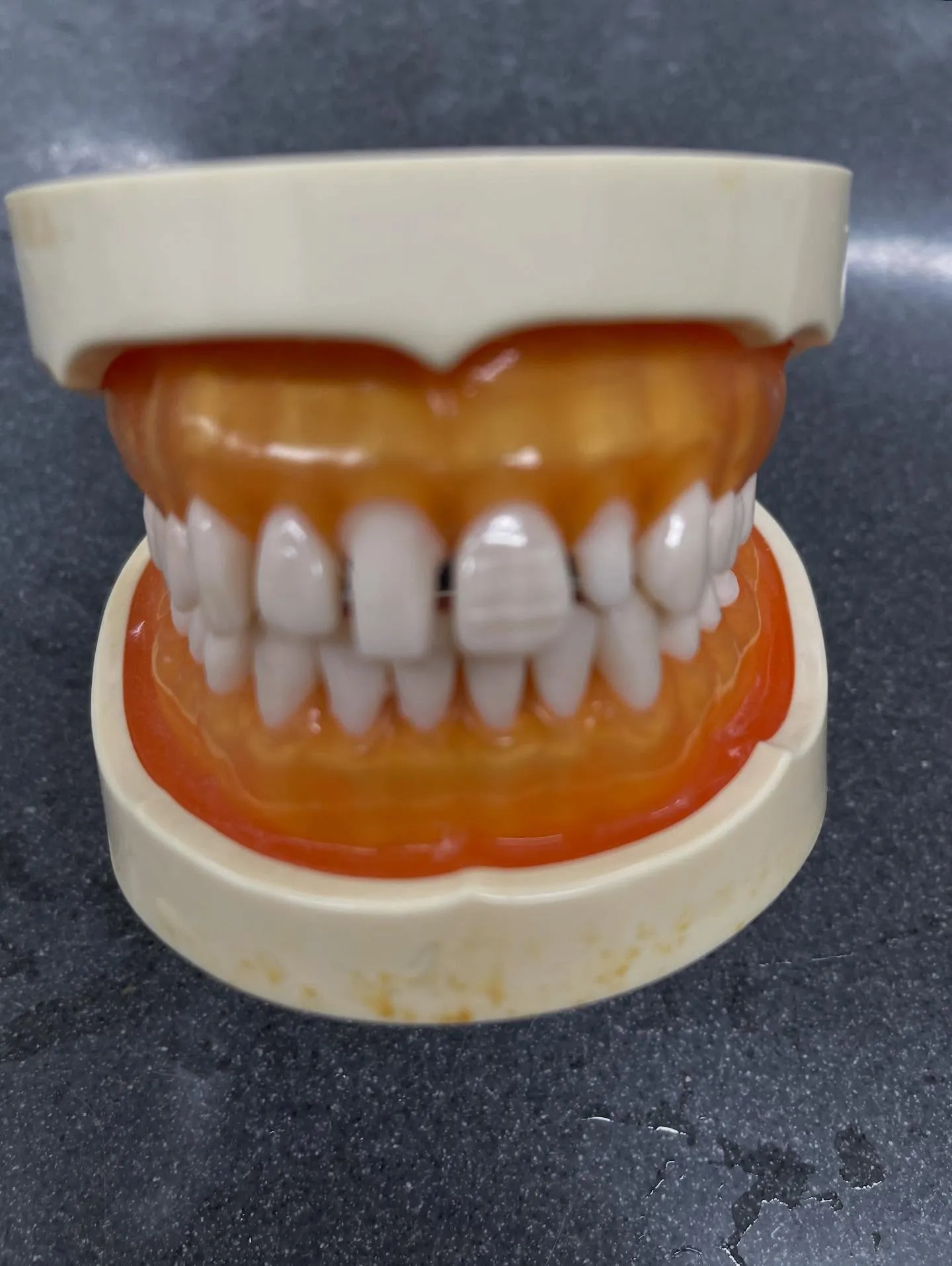 口内炎が長引くと、毎日の生活にも支障を来しますね。