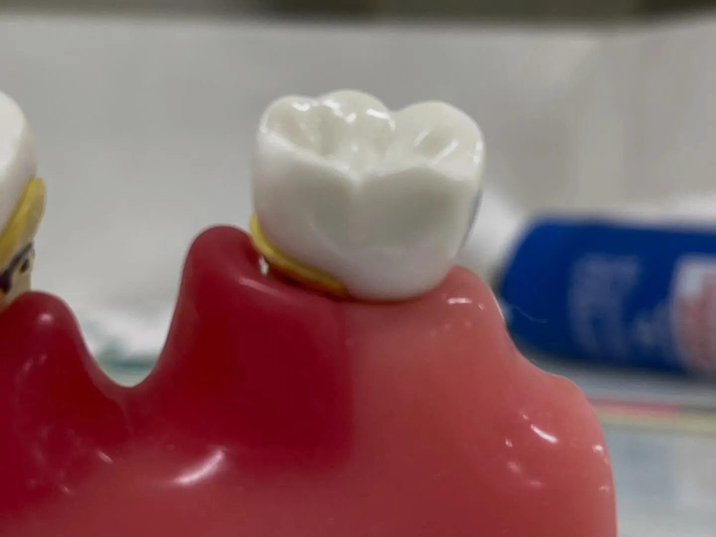 初期の歯肉炎は、多くの方が知らぬ間に経験することのある口腔の...