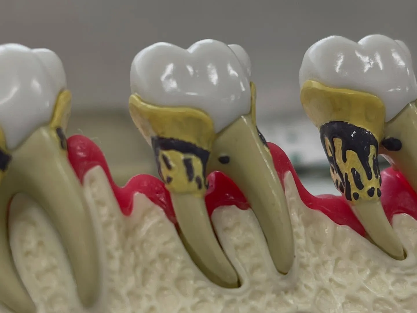 歯の健康は身体全体の健康に直結しています。