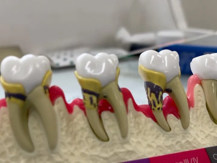 歯の健康は身体全体の健康に直結しています。